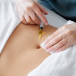 Personalized Fat Melting Injection Treatments