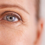 What Makes Fine Lines and Wrinkle Removal Effective