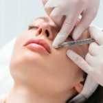 Dermal Fillers