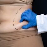 Liposuction Cost