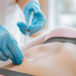 Fat Melting Injections