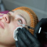 Are Cosmetic Injections Effective for Dark Circles