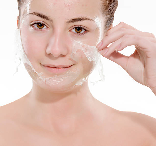Can Chemical Peels Clear Dark Spots