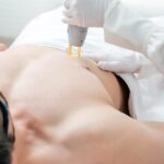 Full Body Laser Hair Removal Cost In Dubai for a Clear Skin