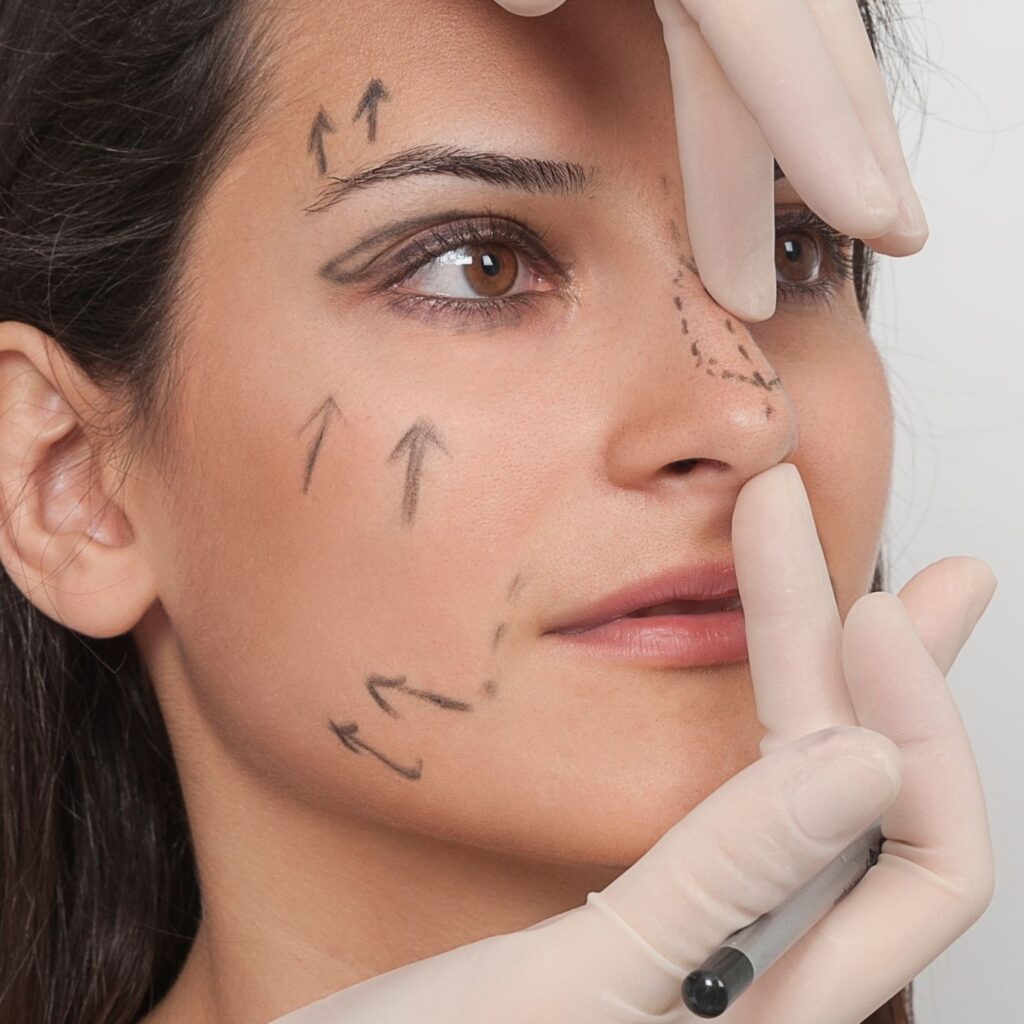 Refine Polished Harmony Professionally Using Rhinoplasty