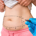 Can Tummy Tuck Boost Confidence