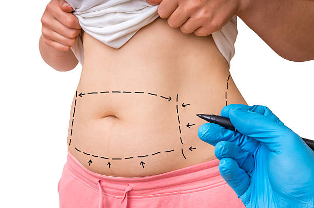 Can Tummy Tuck Boost Confidence