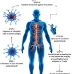Dendritic Cell Therapy