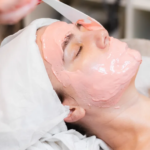 Do Chemical Peels Improve Skin Tone