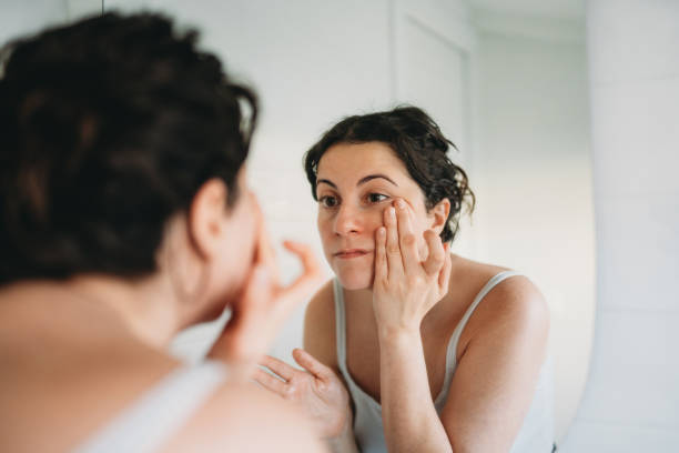 Does Dark Circles Treatment = Reduce Eye Fatigue