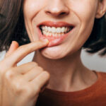 Does Gum Recession Treatment Improve Smiles