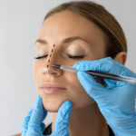 Rhinoplasty Cost in Abu DhabiDoes Rhinoplasty Cost Include Surgeon Fees