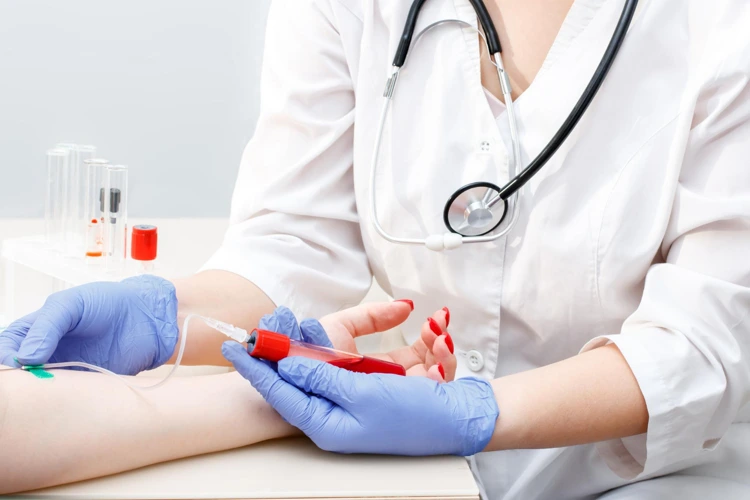 How Accurate Is a Blood Test Result