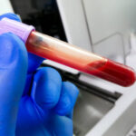 How Accurate Is a Routine Blood Test for Health