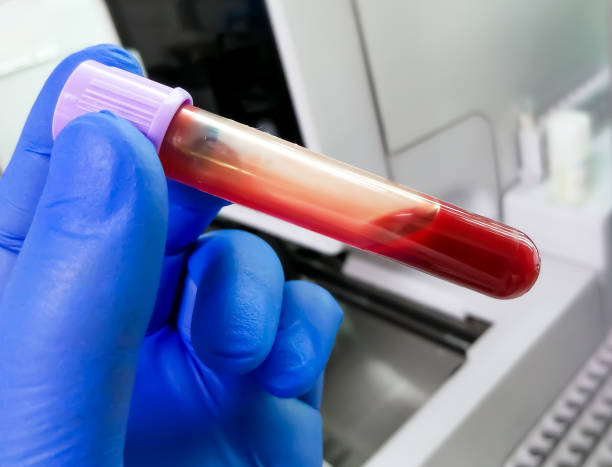 How Accurate Is a Routine Blood Test for Health