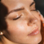 How Can Ultherapy Lift Face Areas