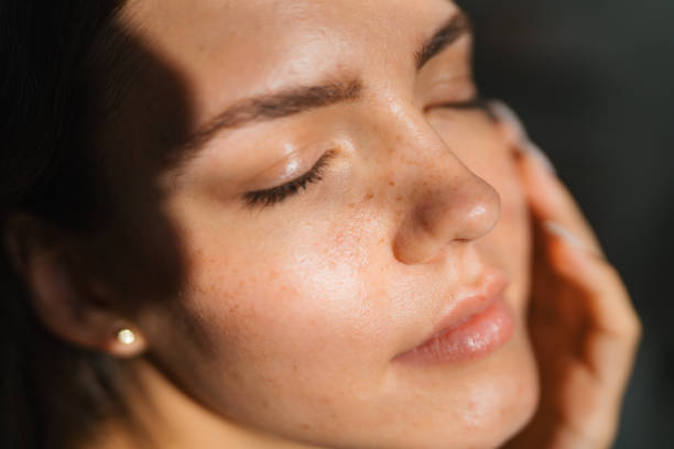 How Can Ultherapy Lift Face Areas
