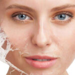 How Do Chemical Peels Improve Your Skin Texture