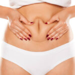 How Does Coolsculpting Work for Fat Loss