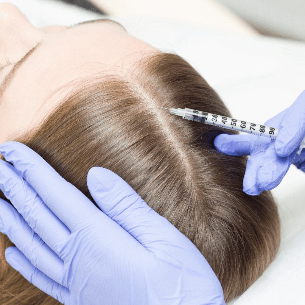 How Does Hair Fillers Treatment Work for Hair Loss