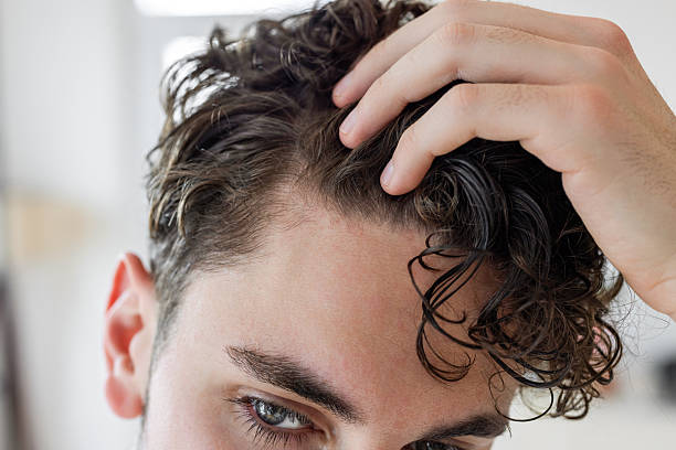 How Effective Is Hair Transplant for Thinning Hair