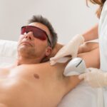How Effective Is Men’s Laser Hair Removal Really