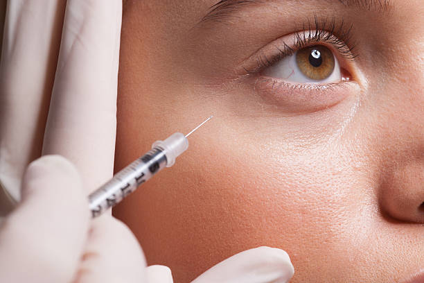 How Long Do Under Eye Fillers Last