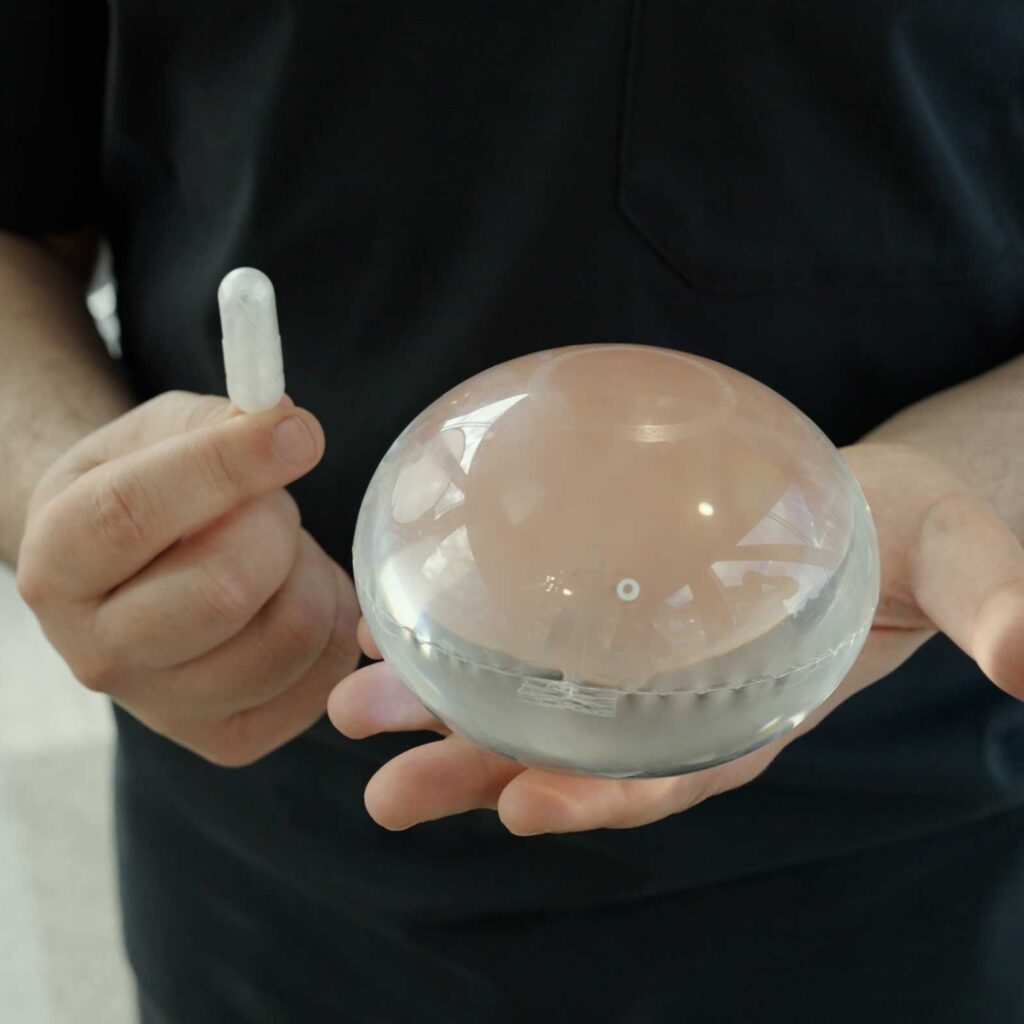 How Long Does Allurion Gastric Balloon Last