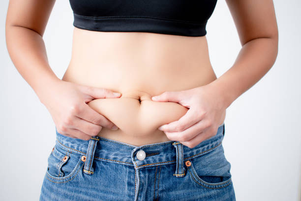 How Many Sessions of CoolSculpting Fat Freezing Are Needed