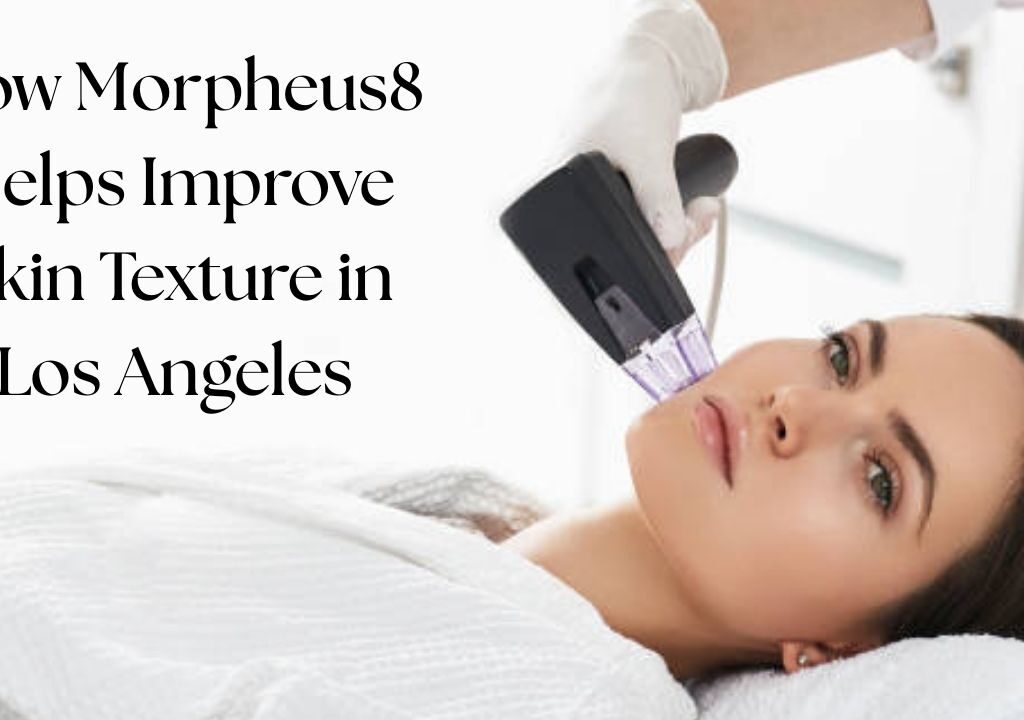 How Morpheus8 Helps Improve Skin Texture in Los Angeles
