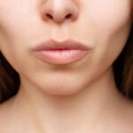 How Safe Is Buccal Fat Removal for Your Face