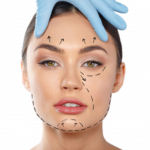 How to Choose the Best Plastic Surgeon for Facial Surgery