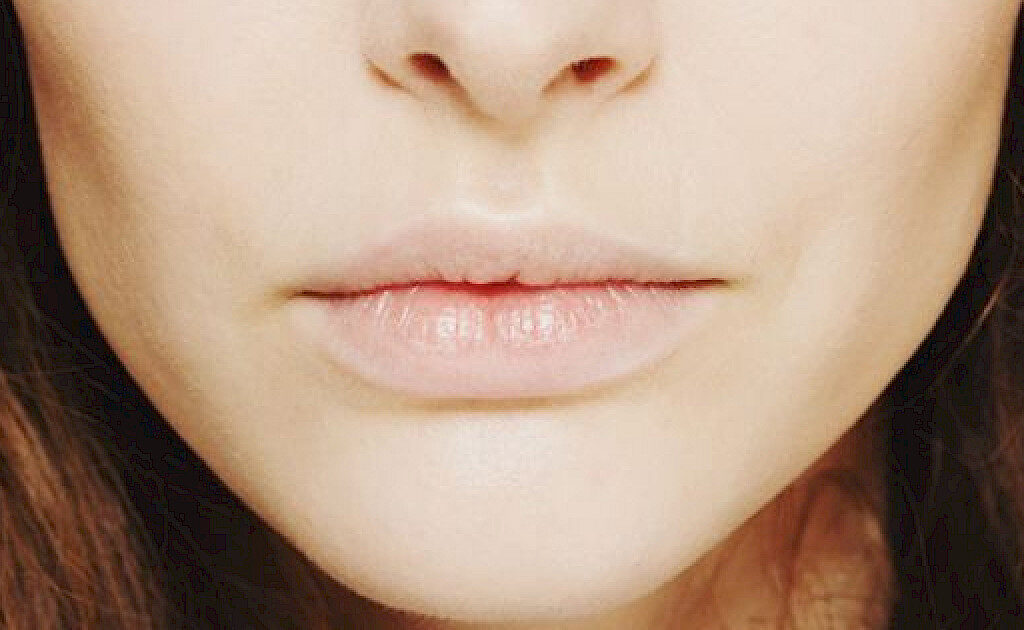 Is Buccal Fat Removal a Quick Procedure