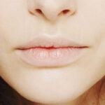 Is Buccal Fat Removal a Quick Procedure