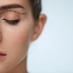 Is Eyelid Surgery Safe for Aging Eyes and Skin