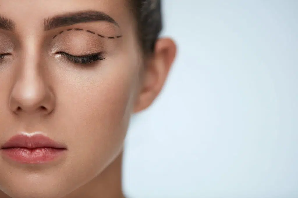 Is Eyelid Surgery Safe for Aging Eyes and Skin
