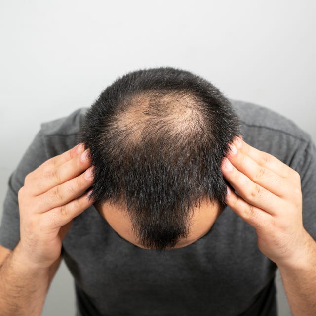 Is GFC Treatment for Hair Worth It for Hair Loss