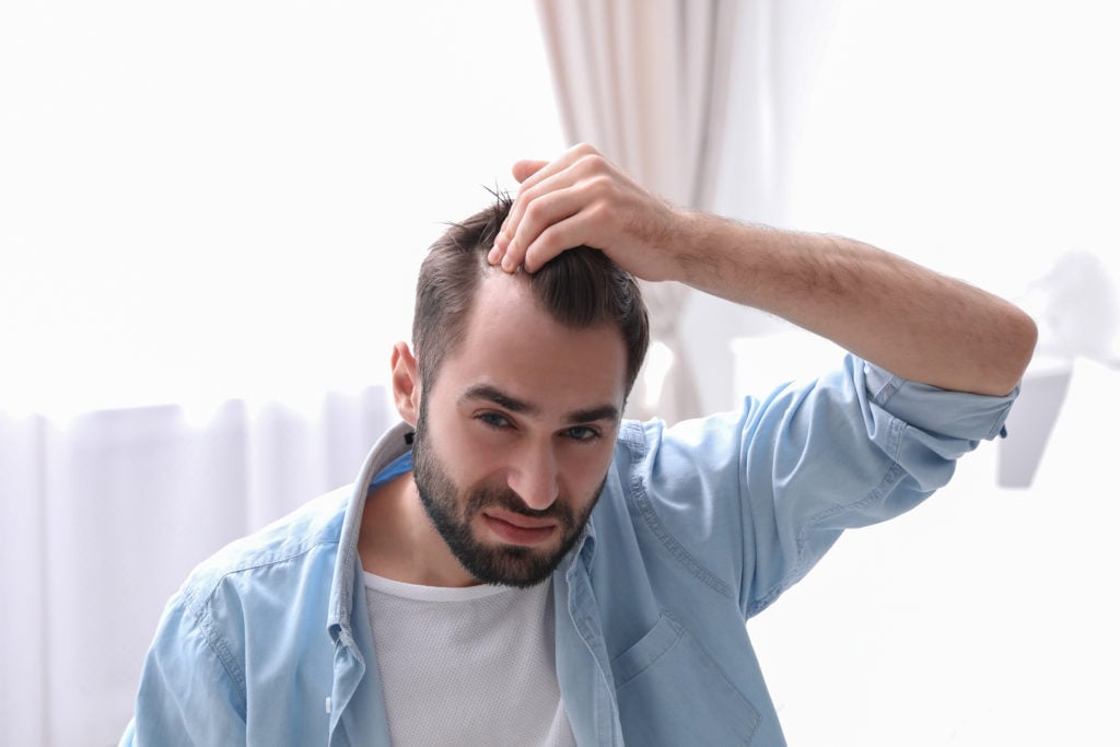 Is Hair Transplant Right for Your Hair Goals