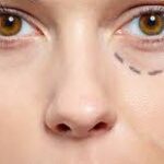 Natural Looking Under Eye Enhancement