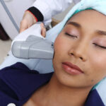 Treatment on Asian Woman as patient to make skin smooth bright and cure acne with medical beauty device instrument cold process on face in hospital clinic