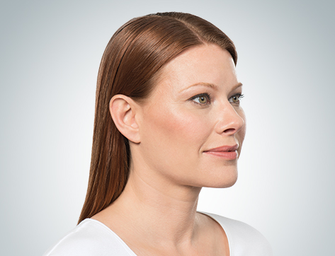 Non-Invasive Jawline Sculpting with Kybella