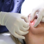 Non-Surgical Lifting Solutions