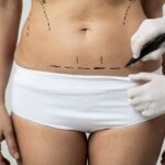 Tummy Tuck Safe Solutions for Stubborn Belly Fat