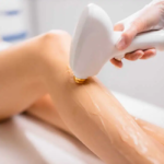 Unlock Hair-Free Confidence with Laser Hair Removal