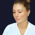 What Results Can Thread Lift Really Deliver