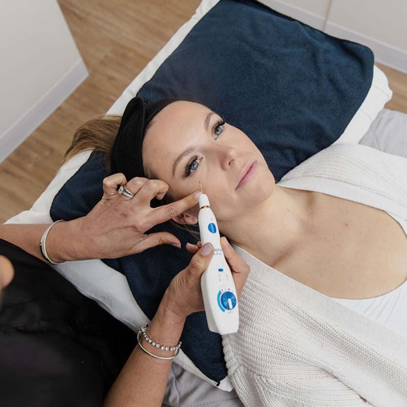 ما هي مشاكل الجلد التي يعالجها علاج قلم البلازما في أبوظبي؟