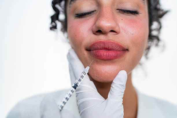 هل حقن فيلر الشفاه للشفتين مناسبة لك؟