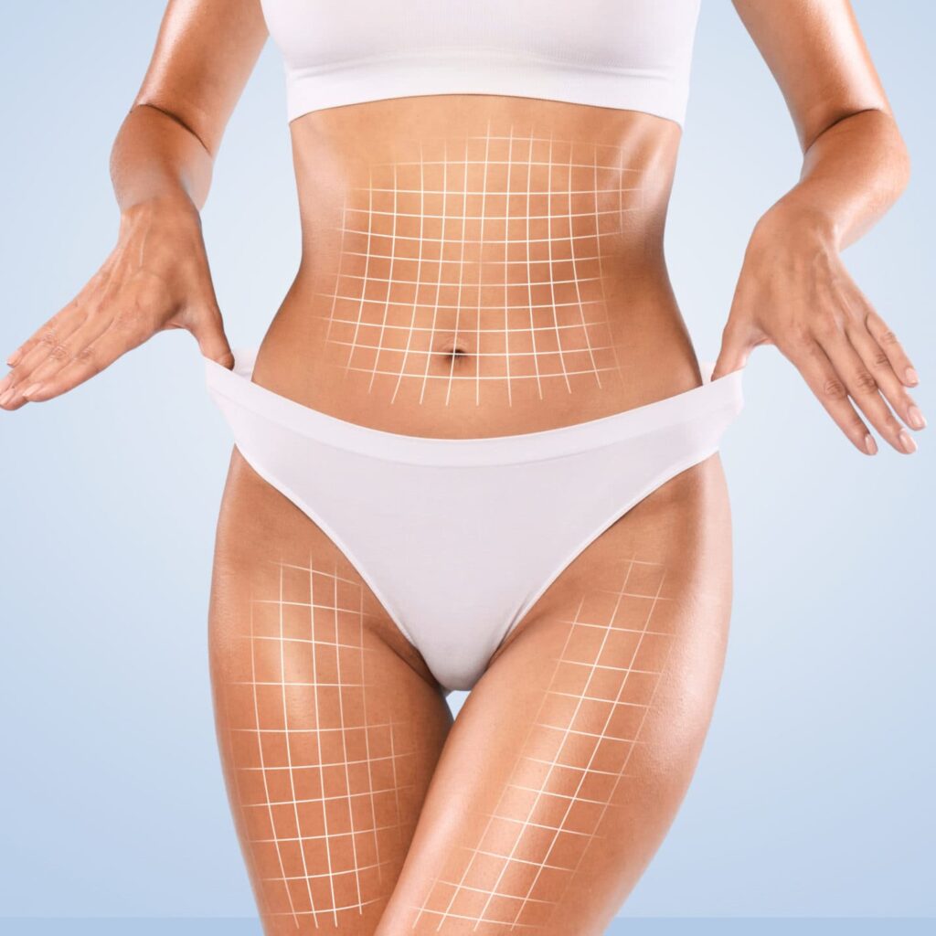 هل علاج نحت الجسم آمن على المدى الطويل؟