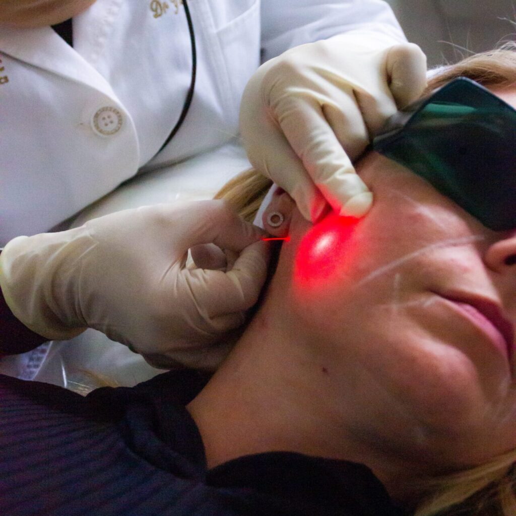 هل يُقلل علاج إندوليفت من دهون الوجه؟